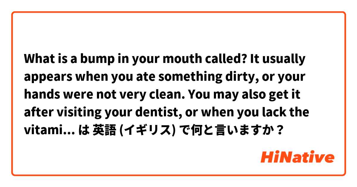 What is a bump in your mouth called? It usually appears when you ate something dirty, or your hands were not very clean. You may also get it after visiting your dentist, or when you lack the vitamin B. は 英語 (イギリス) で何と言いますか？