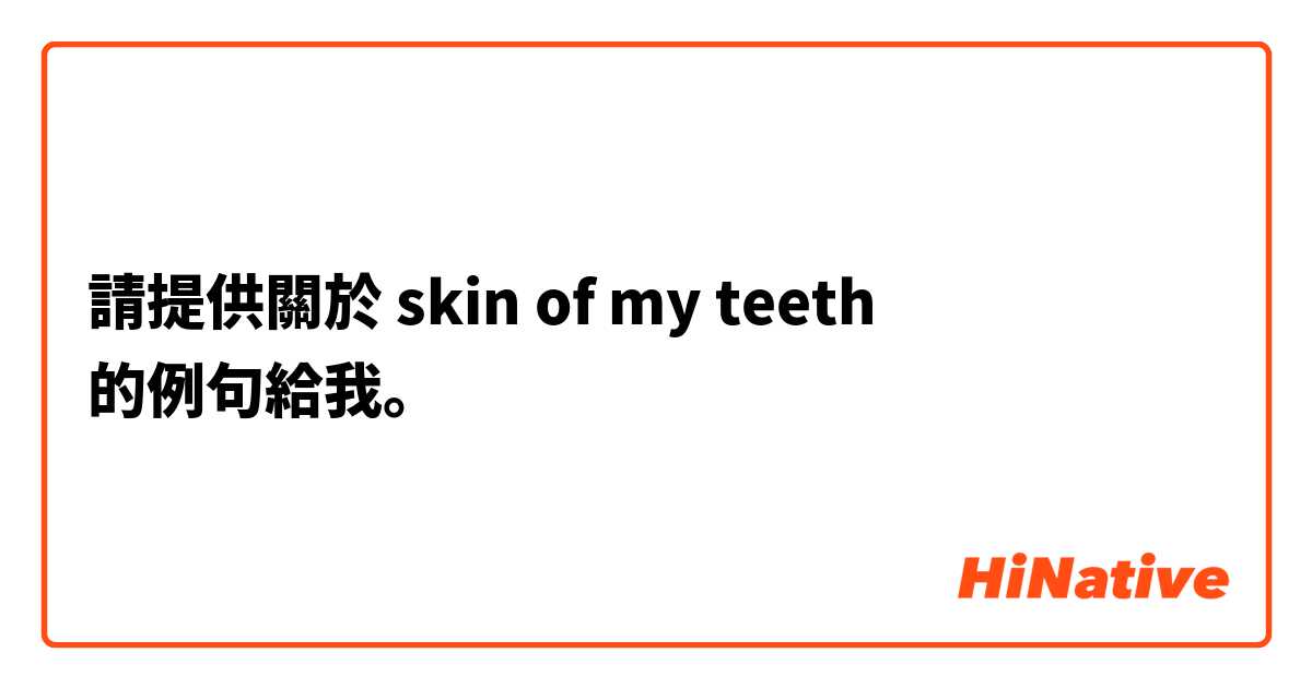 請提供關於 skin of my teeth 的例句給我。